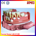 Dental Education Teeth Model for Wholesale